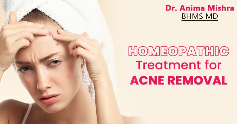 HOMEOPATHY TREATMENT FOR ACNE REMOVAL - Anima Mishra