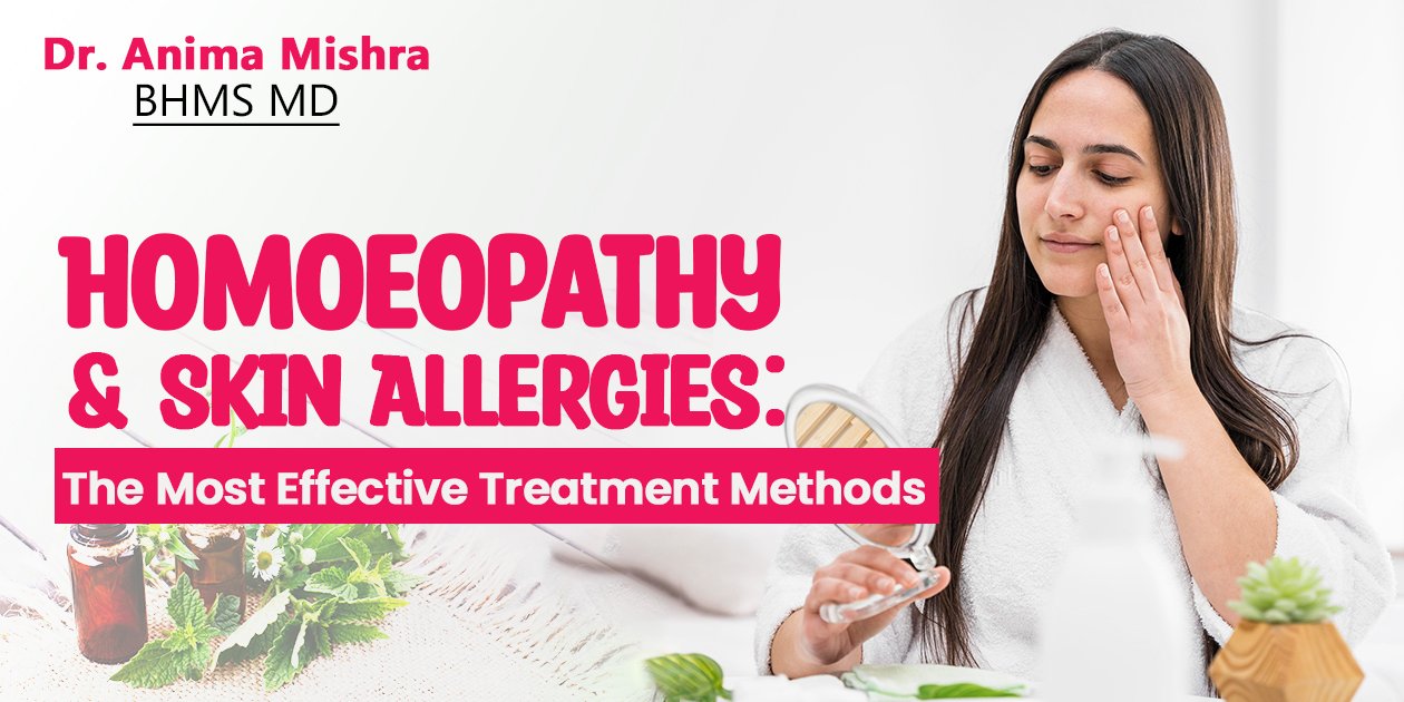Homoeopathy & Skin Allergies: The Most Effective Treatment Methods
