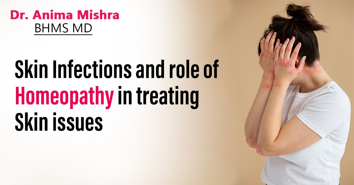 Skin Infections and role of Homeopathy in treating Skin issues