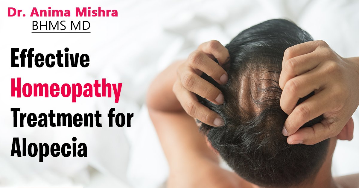 Effective Homeopathy Treatment for Alopecia