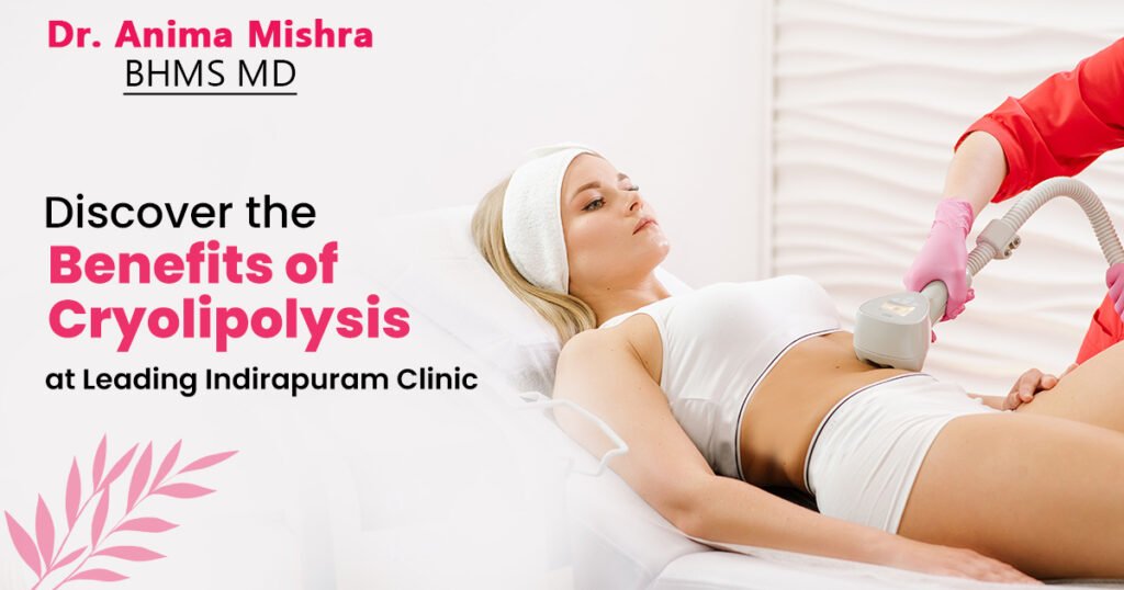 Cryolipolysis Clinic in Indirapuram