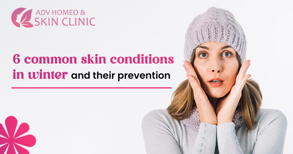 Skin Specialist in Indirapuram: Winter Skin Care Tips